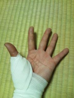 10針ほど縫いました