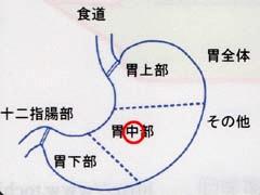 ここが変らしい